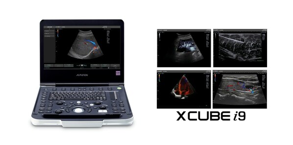 ALPINION Launches a High-Performance Portable Ultrasound Diagnostic Device, X-CUBE i9